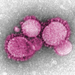Coronavirus in the Time of Climate Change